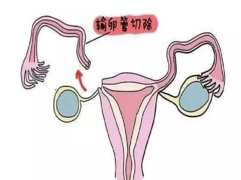 借卵试管婴儿网站，重庆做借卵试管生子选性别费用多少？十万够吗？